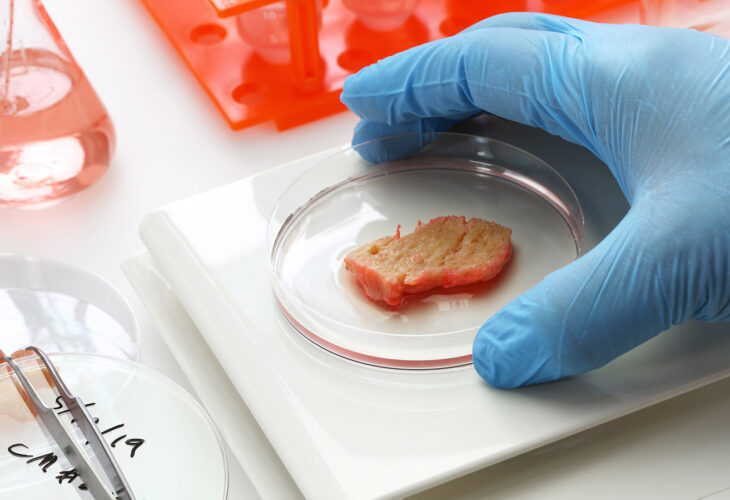 Cell-Cultured Meat Could Hit Grocery Stores In Next 5 Years, Predicts Expert