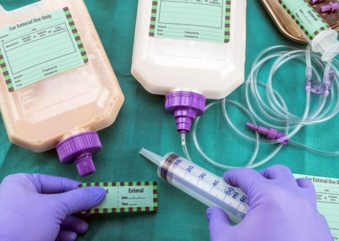 a study fed vegan food through a tube to vegan and non-vegan patients