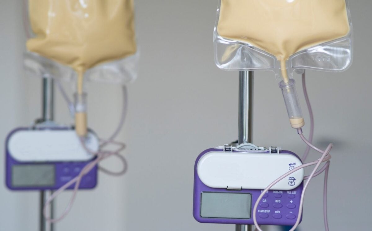 a picture of vegan food through a tube or a tube feeding formula